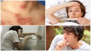 Triệu chứng của bệnh Borreliosis